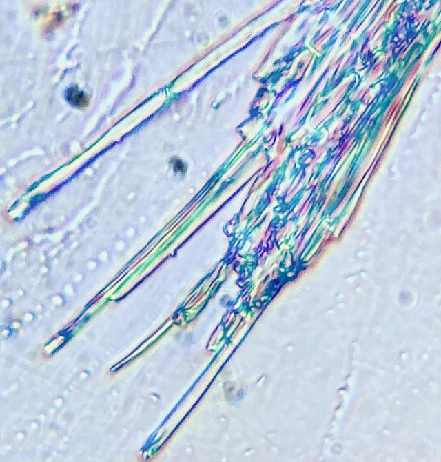 fungi