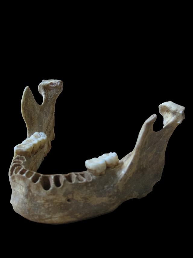 Which part of the body is this bone?