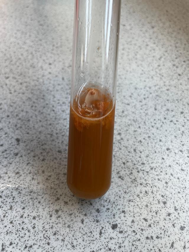 Is this a positive or a negative test for Benedict's solution?