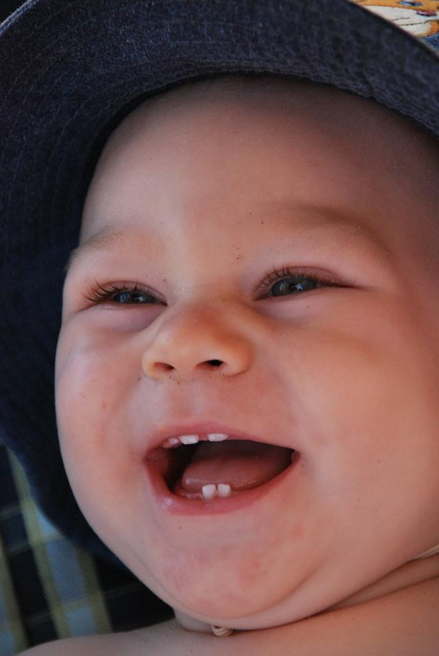 Humans have two sets of teeth in their life time. What is the first set of teeth called?