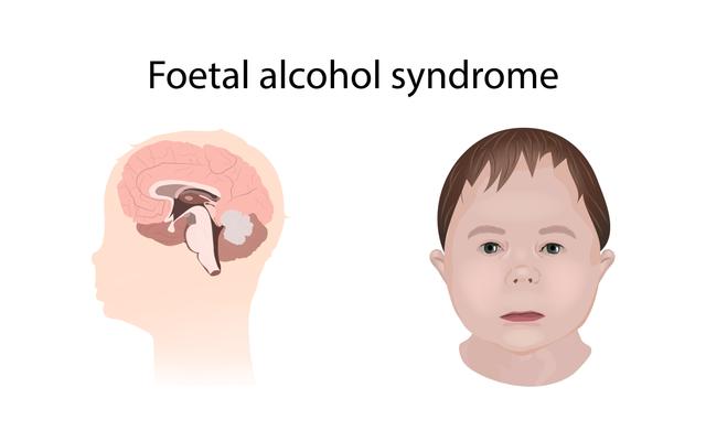 An image in a quiz