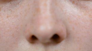 nose