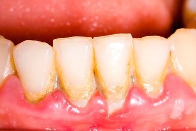 a sticky substance that damages your teeth