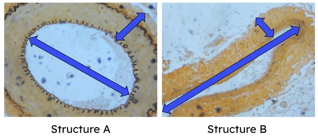 These structures observed using a light microscope are an artery and a vein. Which statements explain why structure B is a vein?