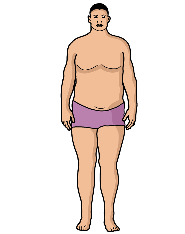 Which somatotype is identified in the image?